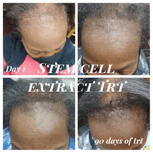 Load image into Gallery viewer, HHS Hair Loss Consultation (In-office or Virtual)