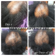 Load image into Gallery viewer, HHS Hair Loss Consultation (In-office or Virtual)