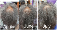 Load image into Gallery viewer, HHS Hair Loss Consultation (In-office or Virtual)