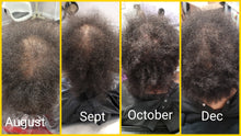 Load image into Gallery viewer, HHS Hair Loss Consultation (In-office or Virtual)