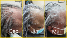 Load image into Gallery viewer, HHS Hair Loss Consultation (In-office or Virtual)
