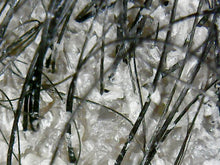 Load image into Gallery viewer, HHS Virtual Hair Loss Consultation