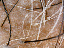 Load image into Gallery viewer, HHS Hair Loss Consultation (In-office or Virtual)