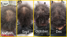 Load image into Gallery viewer, HHS Hair Loss Consultation (In-office or Virtual)
